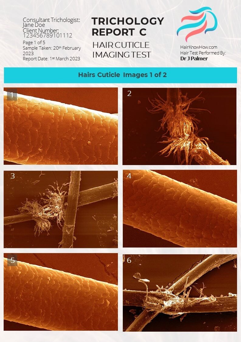 Trichology Analysis Package Cuticle Images SEM