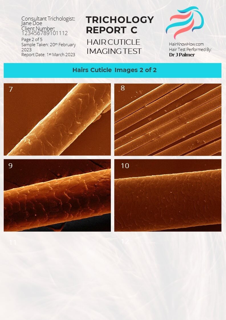 Trichology Analysis Package Cuticle Images SEM