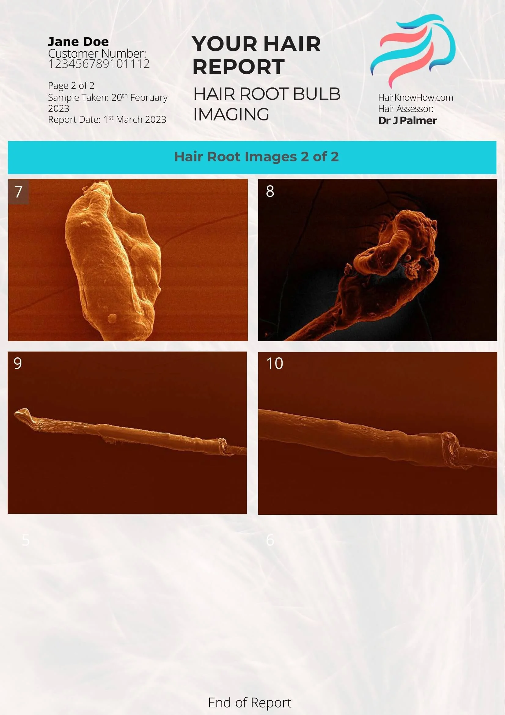 Hair Clinic Root Bulb Imaging Test: Uncover Comprehensive Insights ...