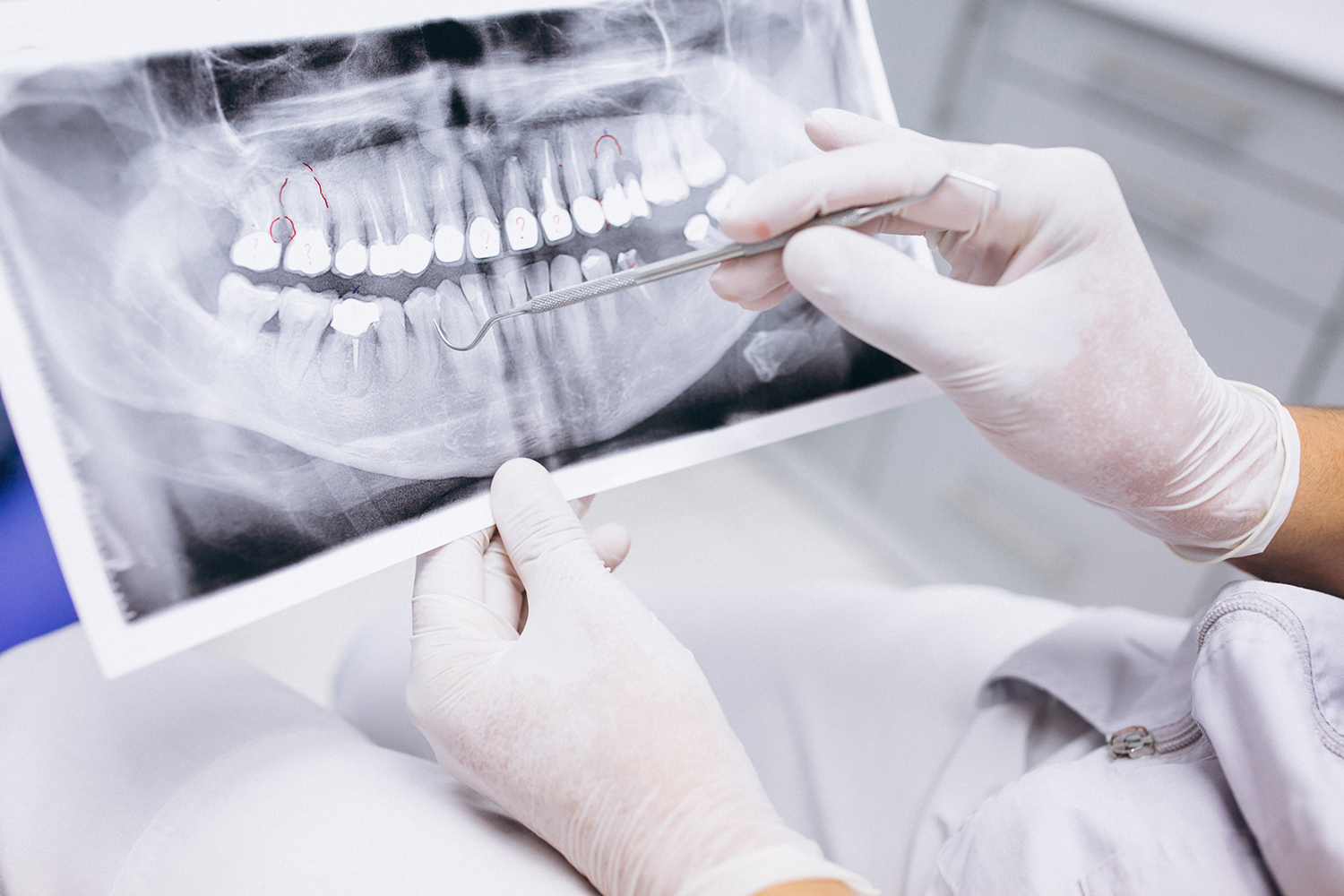 Best ways to replace missing teeth
