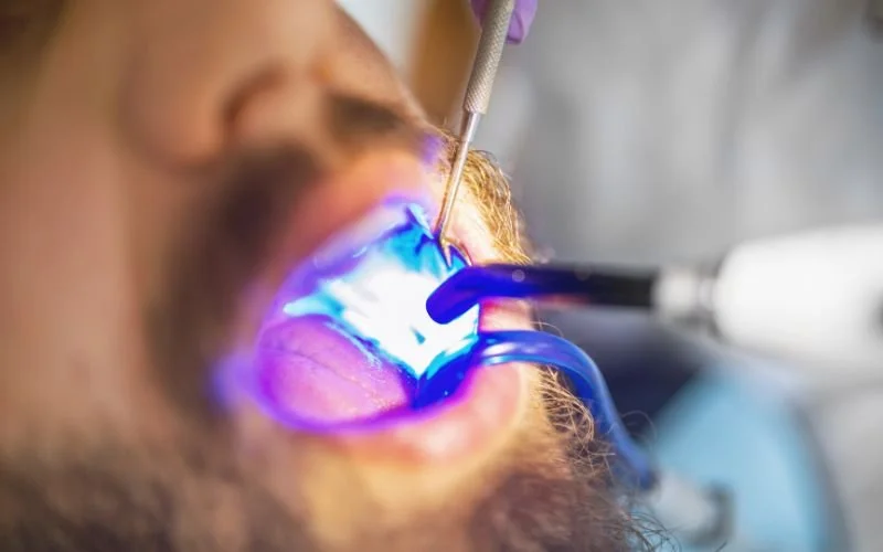 What is a dental filling and when should we perform this treatment?