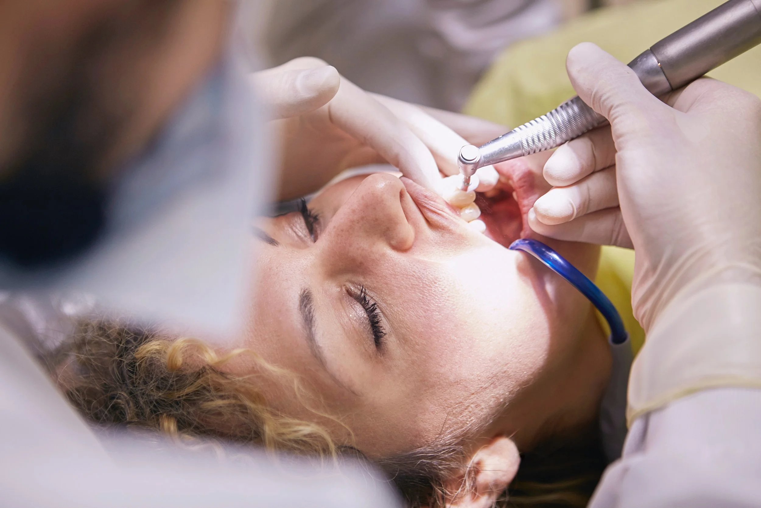 Dental Implants in Tijuana: A Healthy and Long-Lasting Smile
