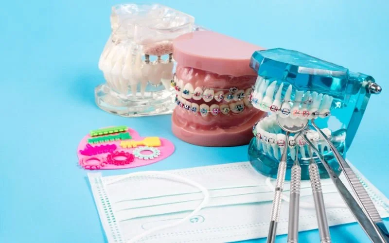 Orthodontics in Tijuana