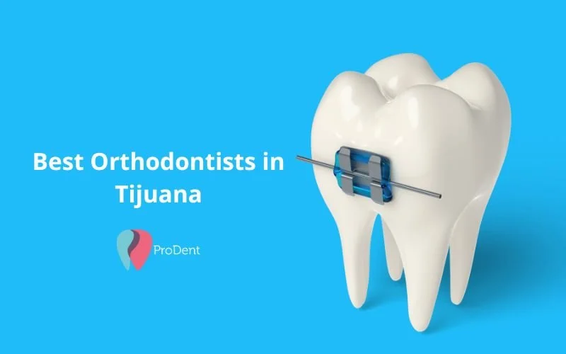 Sapphire brackets