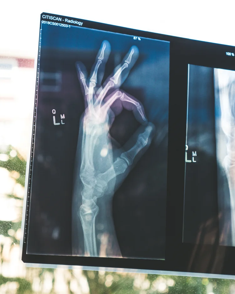 Orthopaedics & Painkiller Products