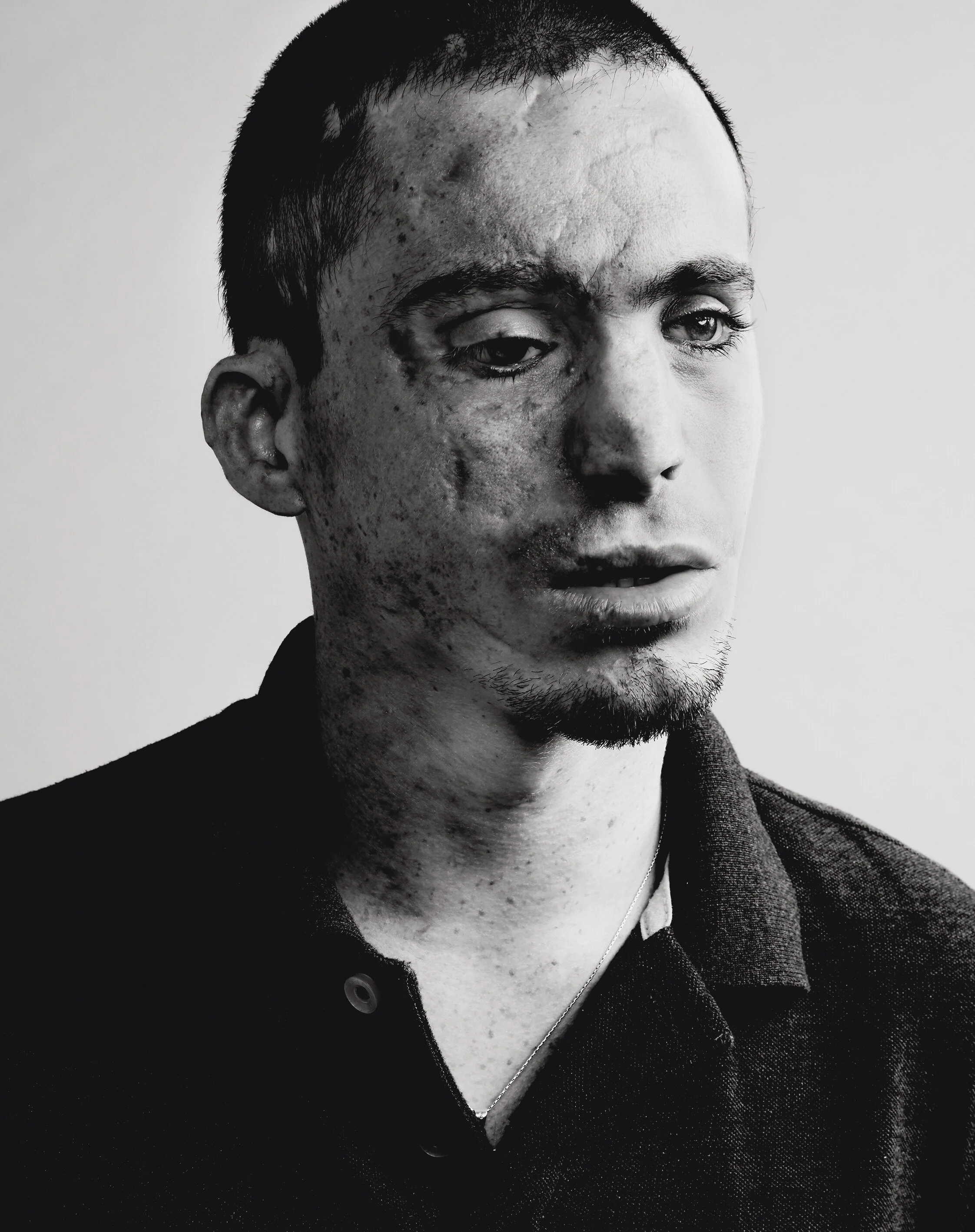 Victim Of A Terrorist Attack, Tel Aviv, Israel