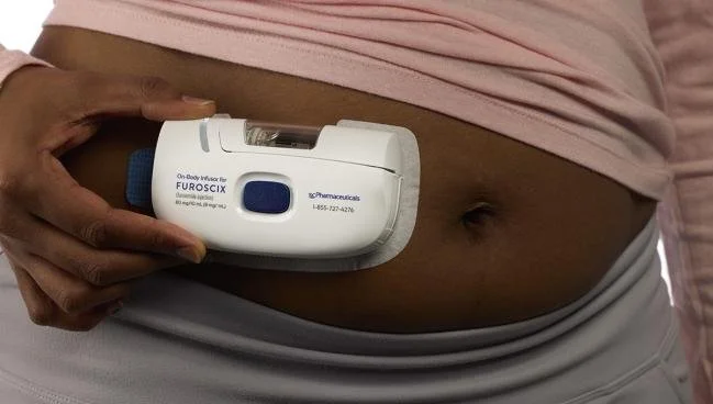 Subcutaneous Furosemide Enables HF Patients to Address Congestion at Home.jpg