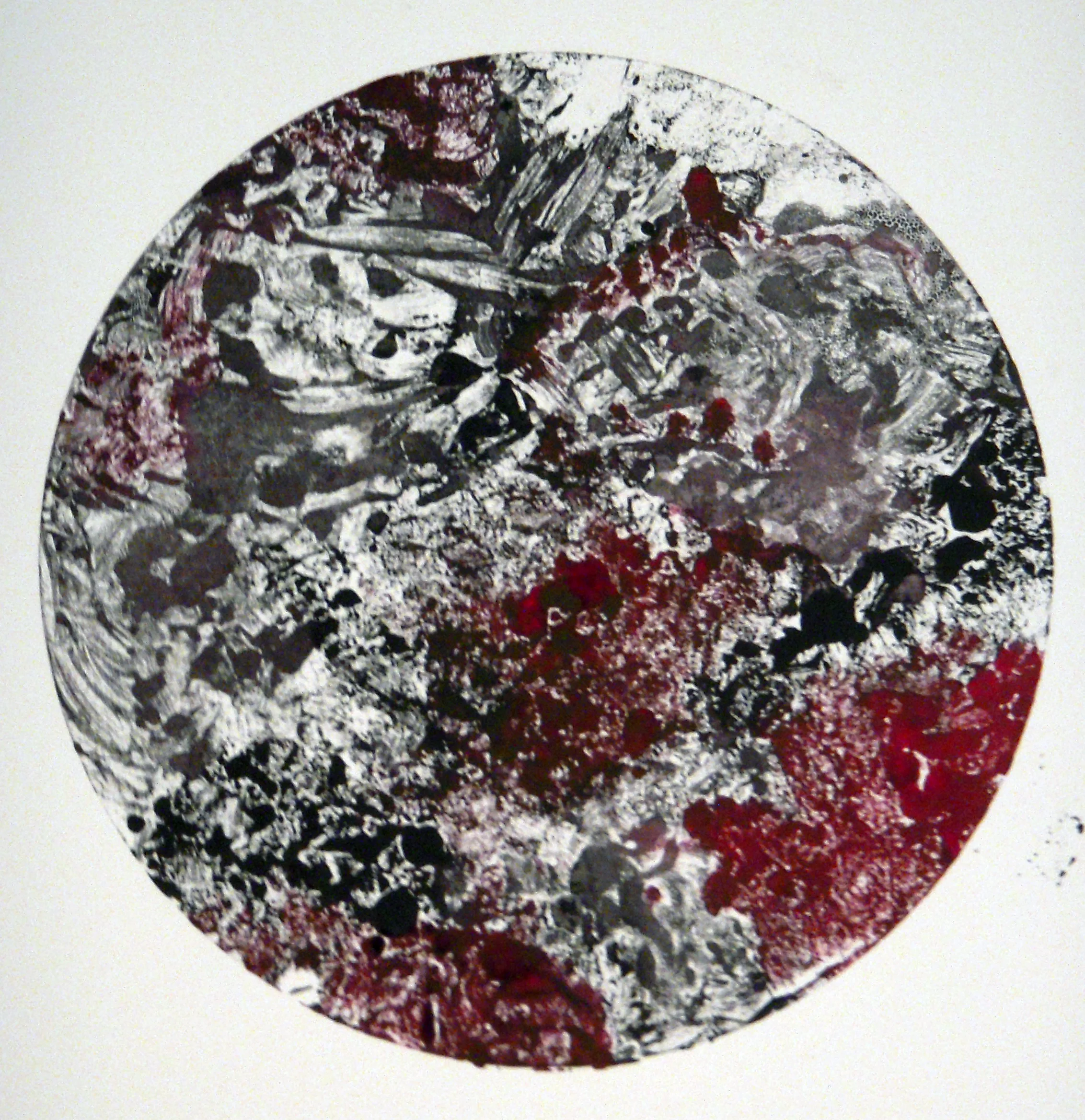 Congestive Heart Failure.JPG