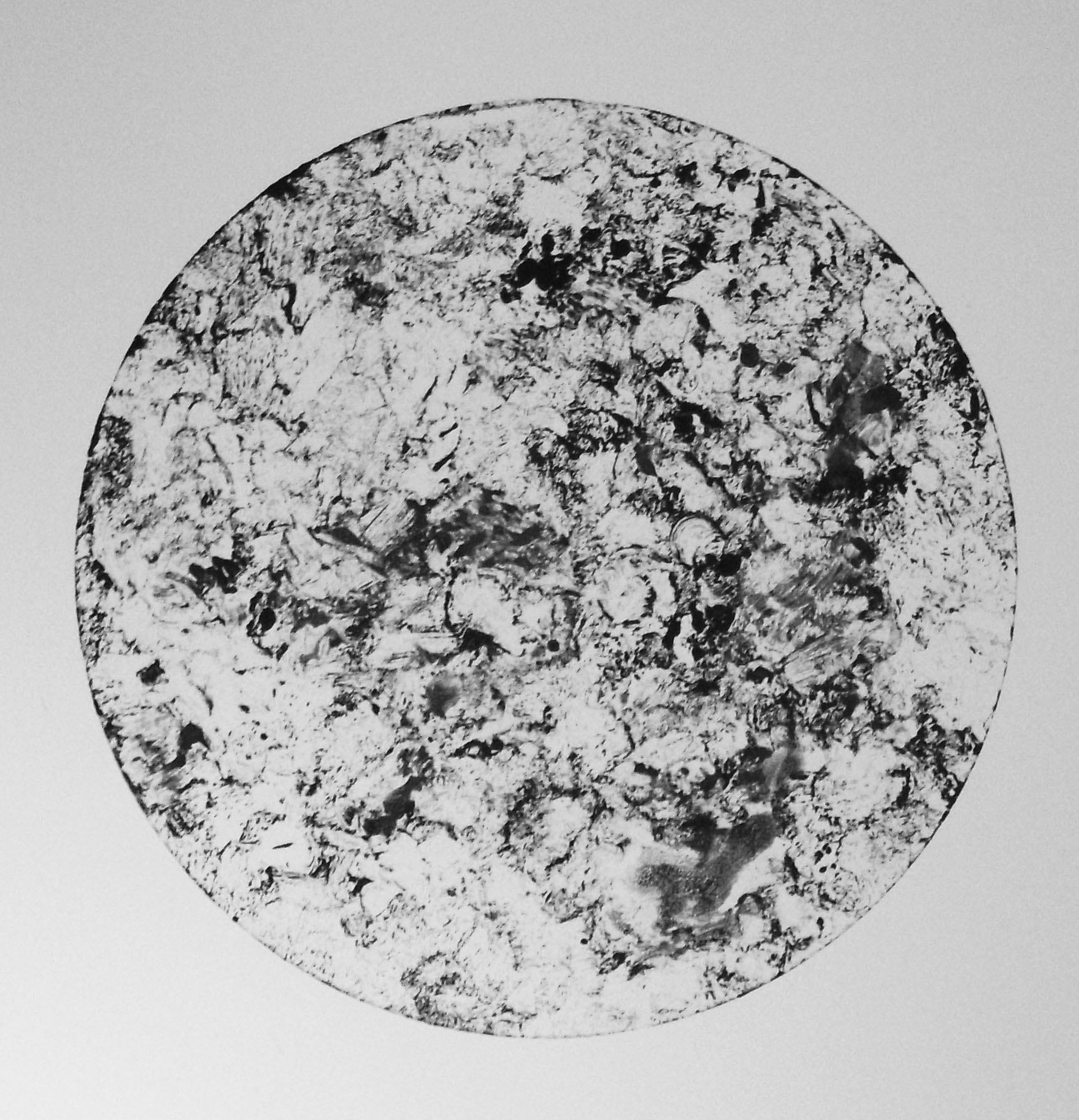 Shadow on the Lungs.JPG