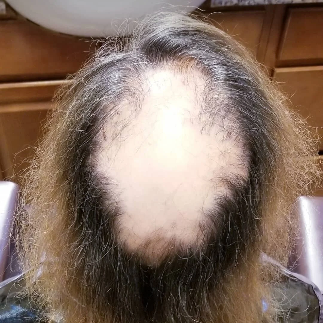 Hair RESTORED.

Custom colored and custom made @zhaircollection unit for this client who suffers from alopecia. The unit can either be clipped on, sewn on or glued on. The choice is yours.

#ziggyartistry 
#hair #hairextensions #rocklandhairextension