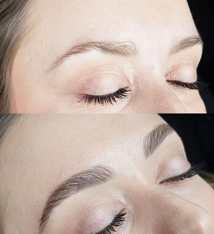 brow-before-after.jpg