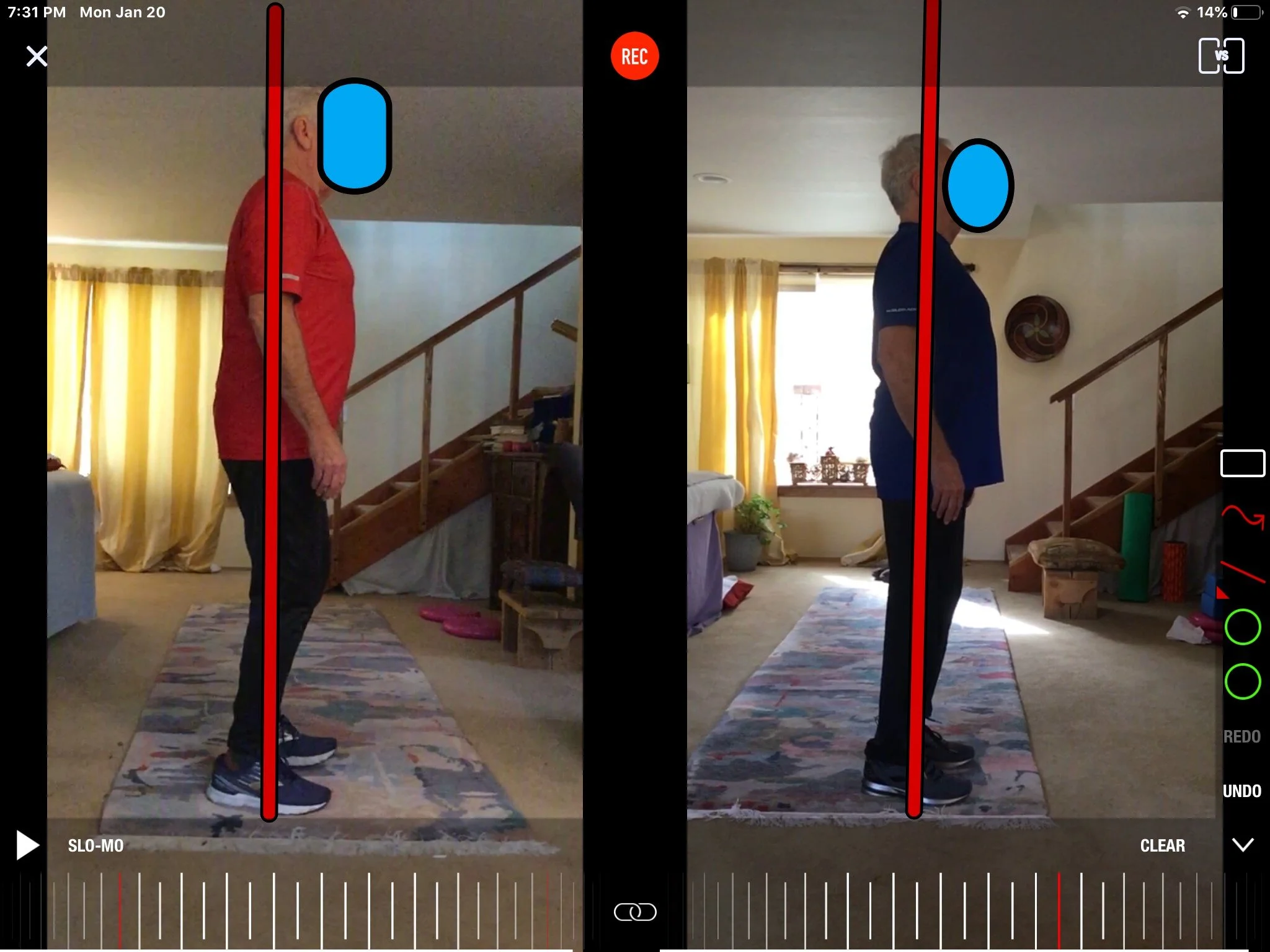 Dale - before and after alignment - Ear over shoulders over hips over ankles 