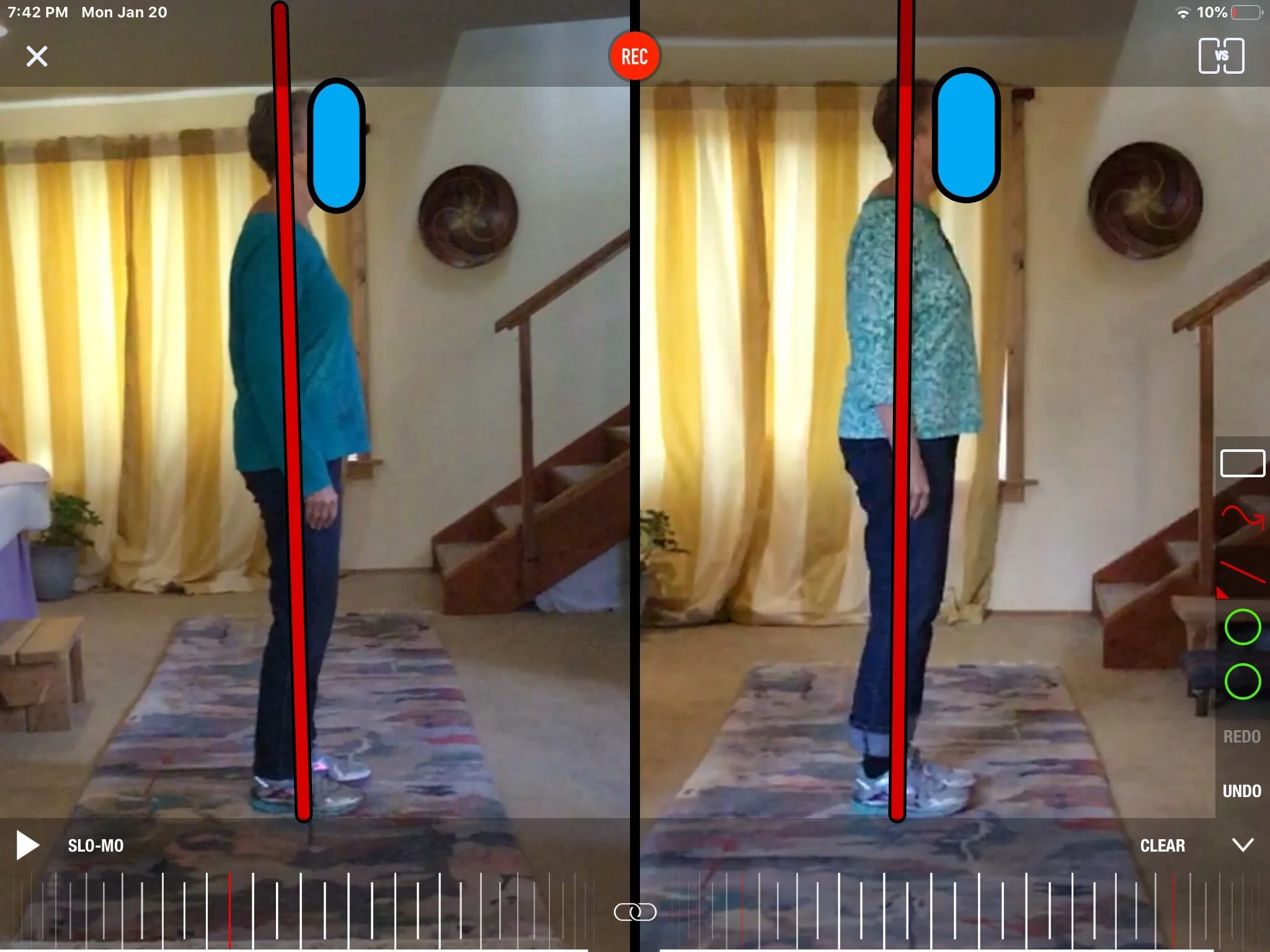  Margie before and after alignment - ear over shoulder over hips over ankle 