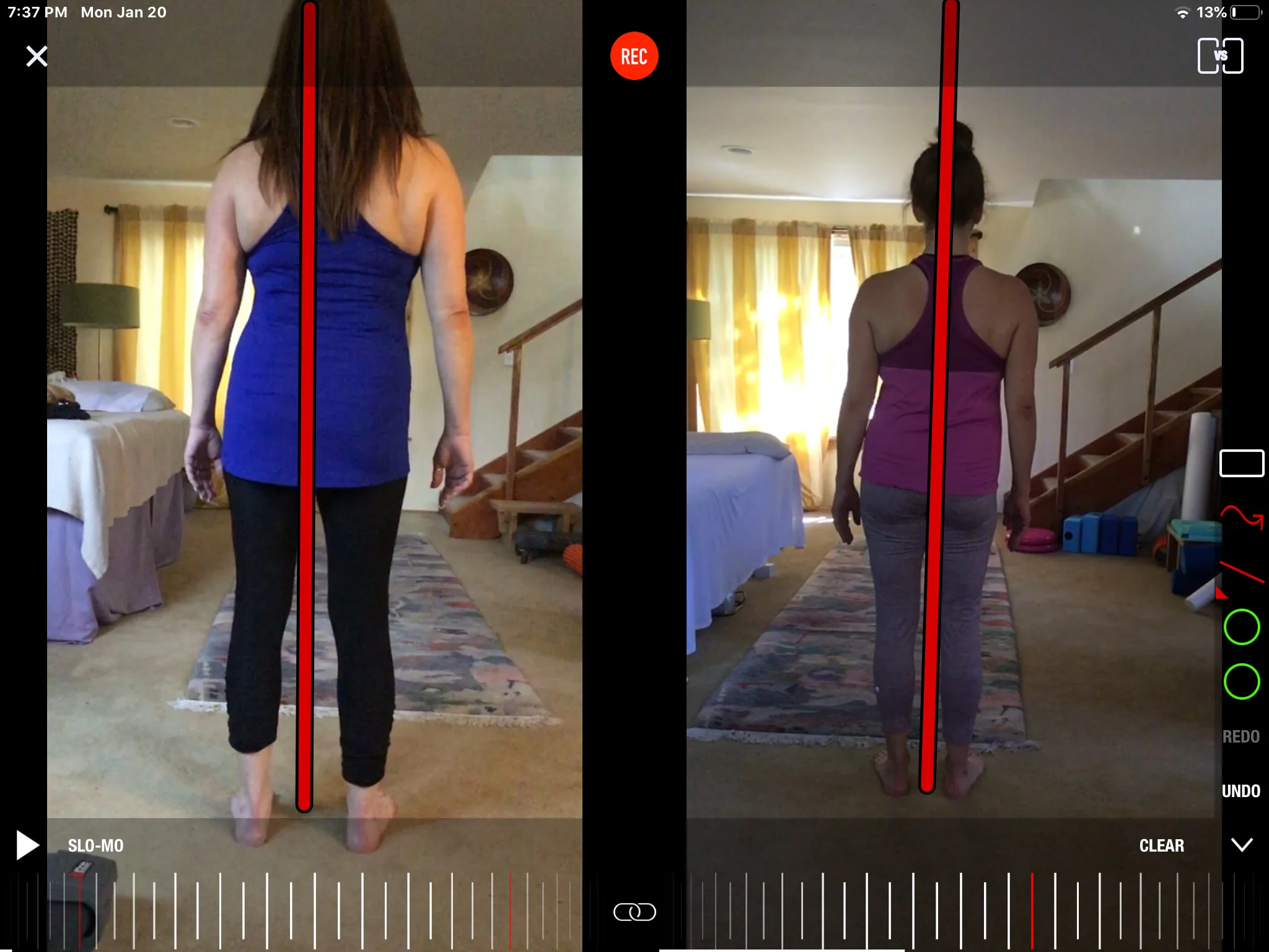  Ann’s before and after alignment 