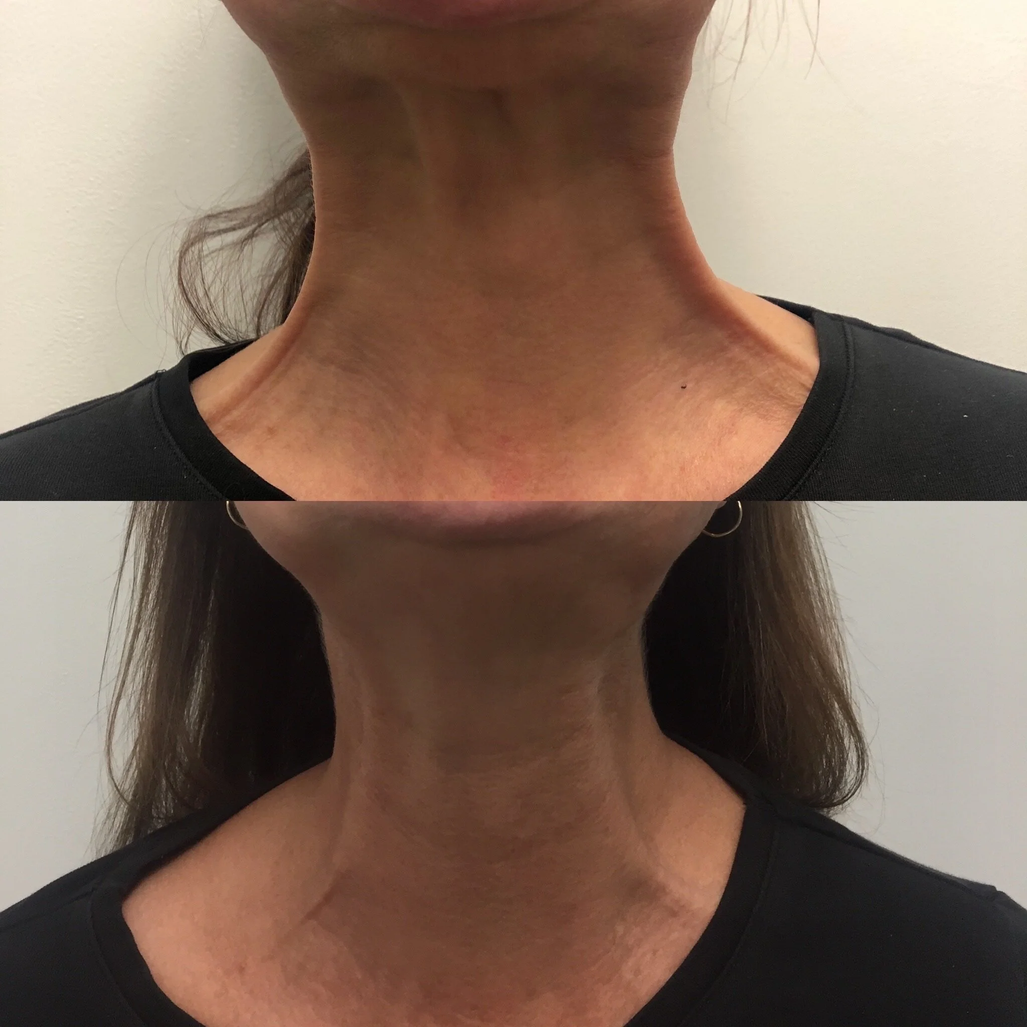  neck band correction  