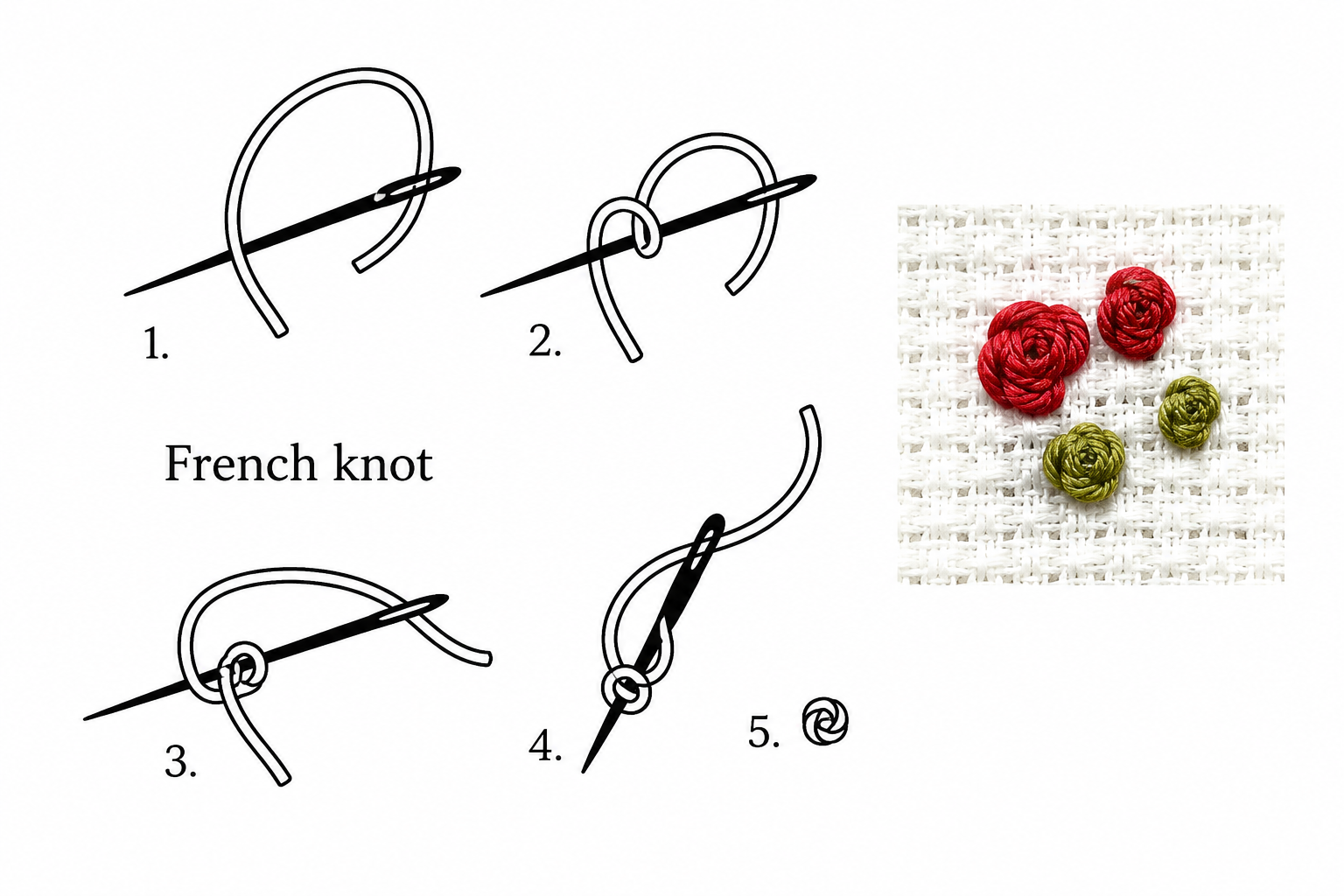 Types of Stitches 
