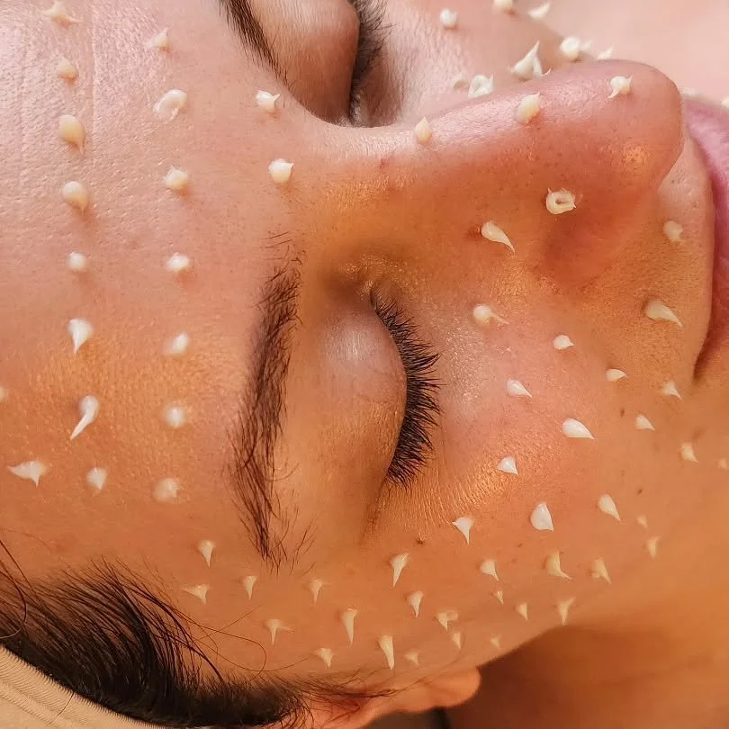 Tiny needles, big results. ✨
Obsessed with Cellstory liquid microneedling.
#skincareobsessed #cellstory