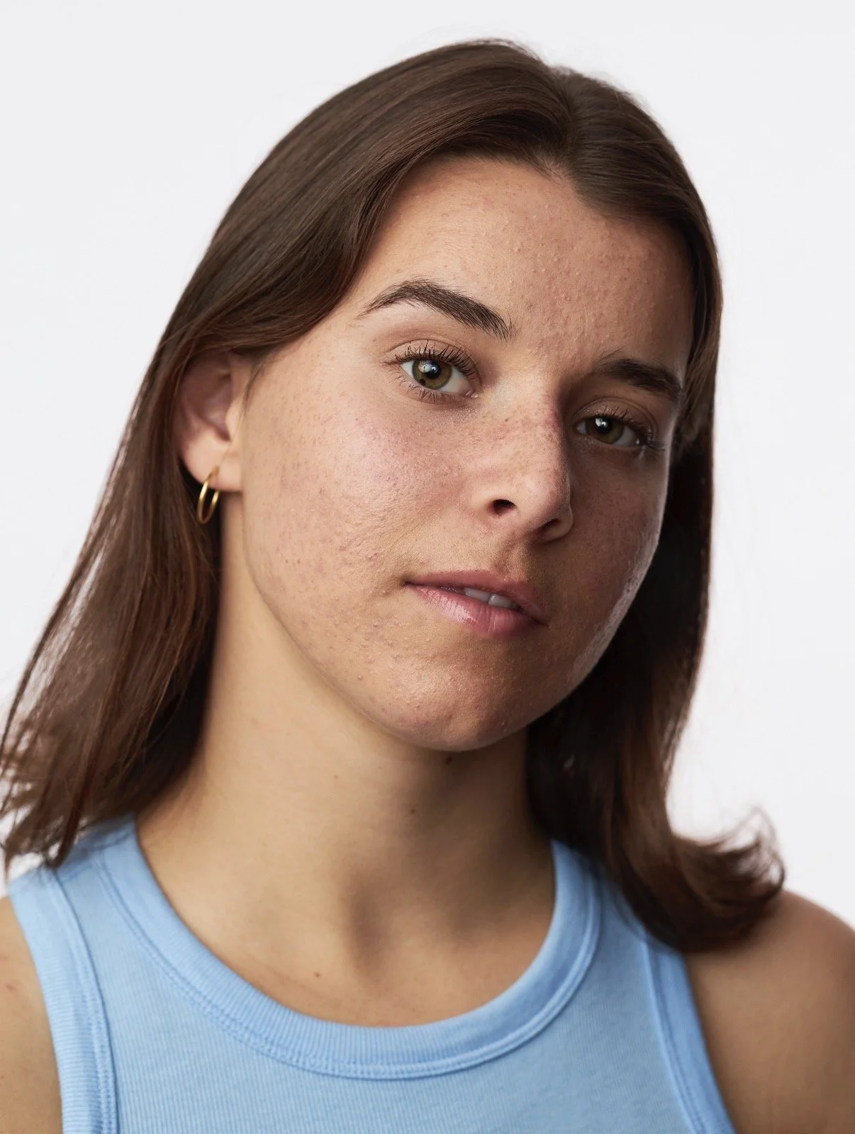 Close-up portrait of a young woman with brown hair, brown eyes, wearing a light blue sleeveless top and small hoop earrings, with visible acne or skin imperfections, against a plain light background.