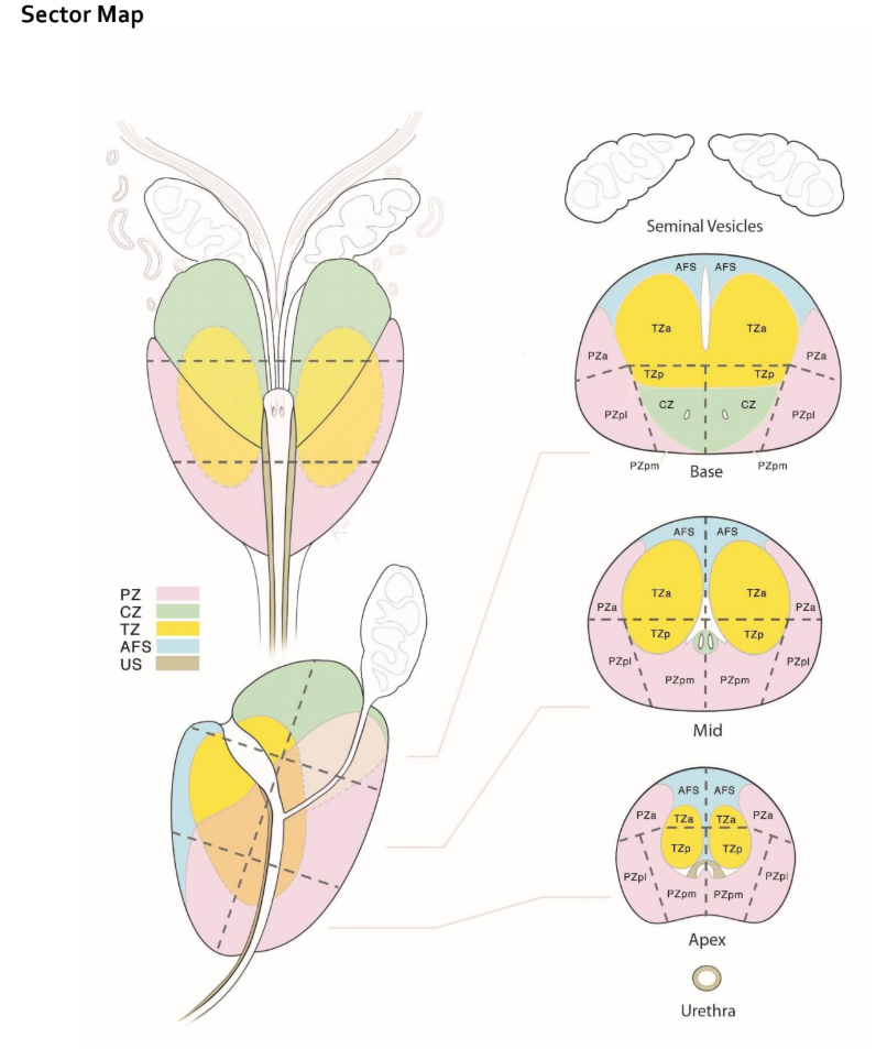 PI RADS Sector Map.png
