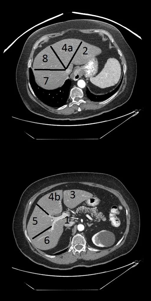 hepatic-segments.jpg