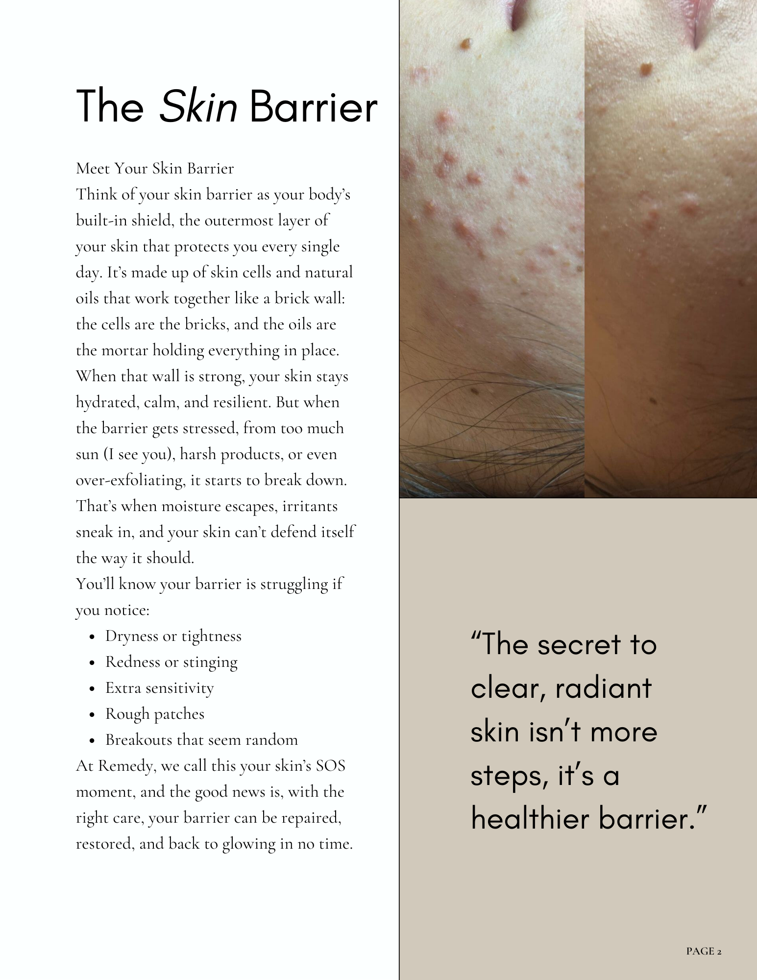 Copy of eBook The Barrier Repair Guide.png