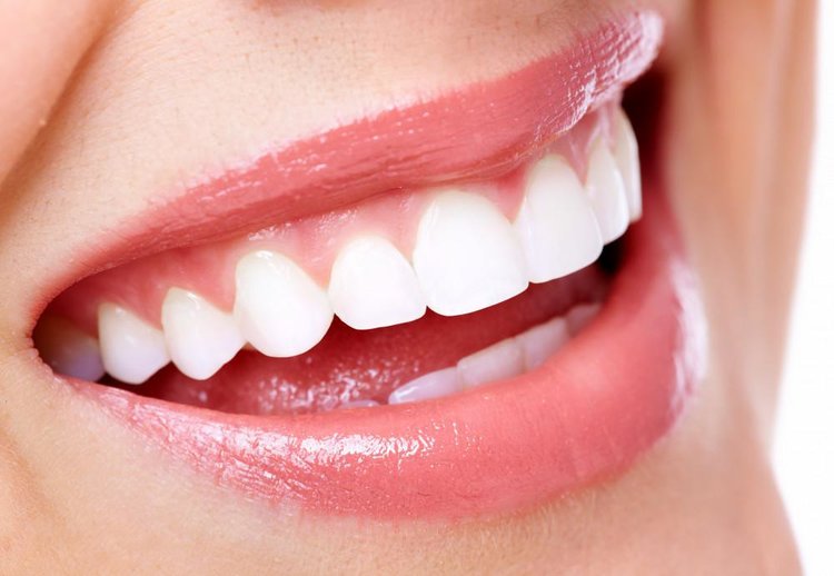 5 Tips for Maintaining Brightness After a Professional Teeth Whitening Treatment Roach Family Dentistry