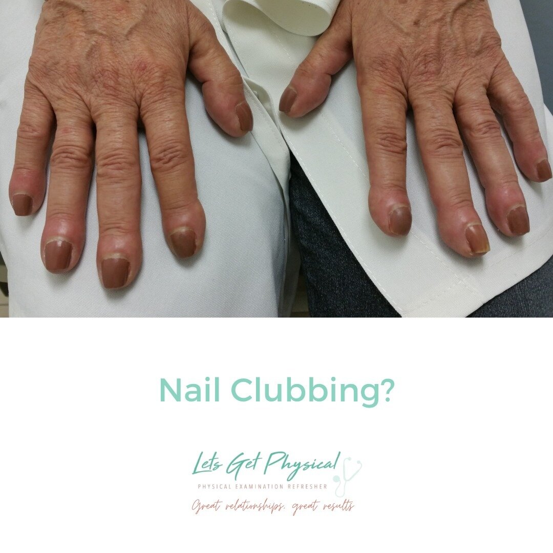 Nail clubbing is both a complementary and convention medicine sign (you can add it to your referral letter to a GP!). ⁠
It is present in more chronic conditions of the respiratory (and quite a few other) system. ⁠
Being non-specific, it is important 