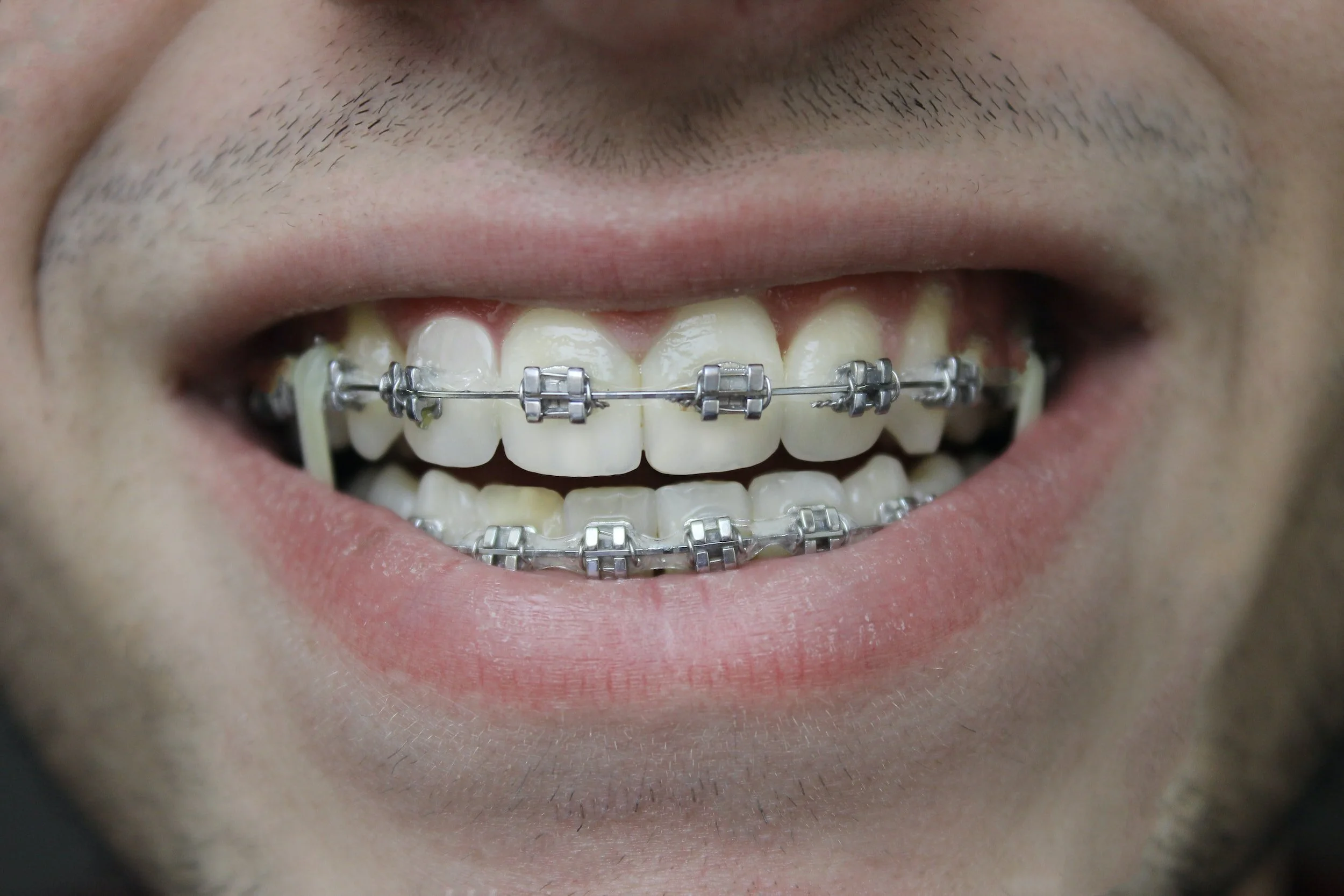 L'orthodontie 