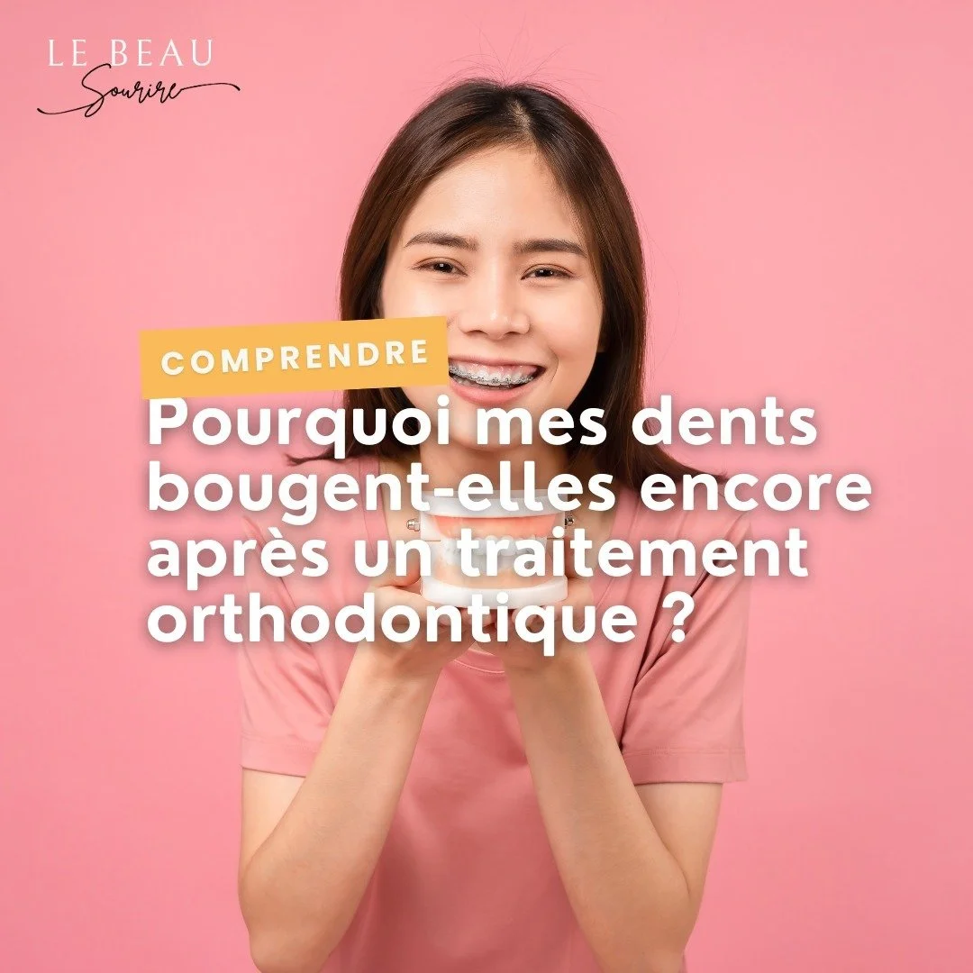 Pourquoi mes dents bougent-elles encore après un traitement orthodontique ? 🔄
Même après un traitement orthodontique, les dents peuvent bouger au fil du temps. Ce phénomène est naturel, car les dents sont en consta