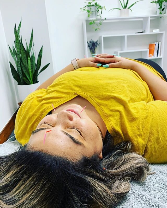 A C U P U N C T U R E ✨

Acupuncture is a safe and effective therapy that uses hair-thin, single-use, sterile needles to activate your body&rsquo;s natural healing response.

When you insert a needle into a specific location of the body, you&rsquo;re