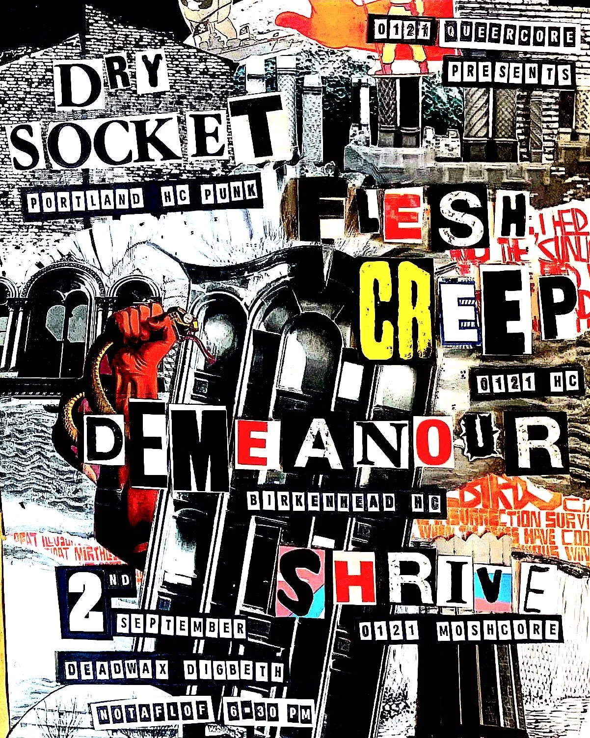 Dry Socket
