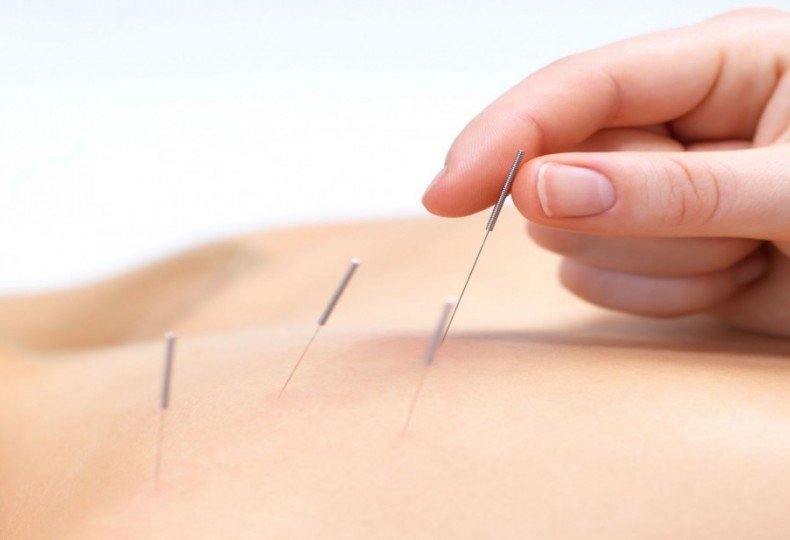 Special Offer for students and new acupuncture practitioners (Two or less years of practice)