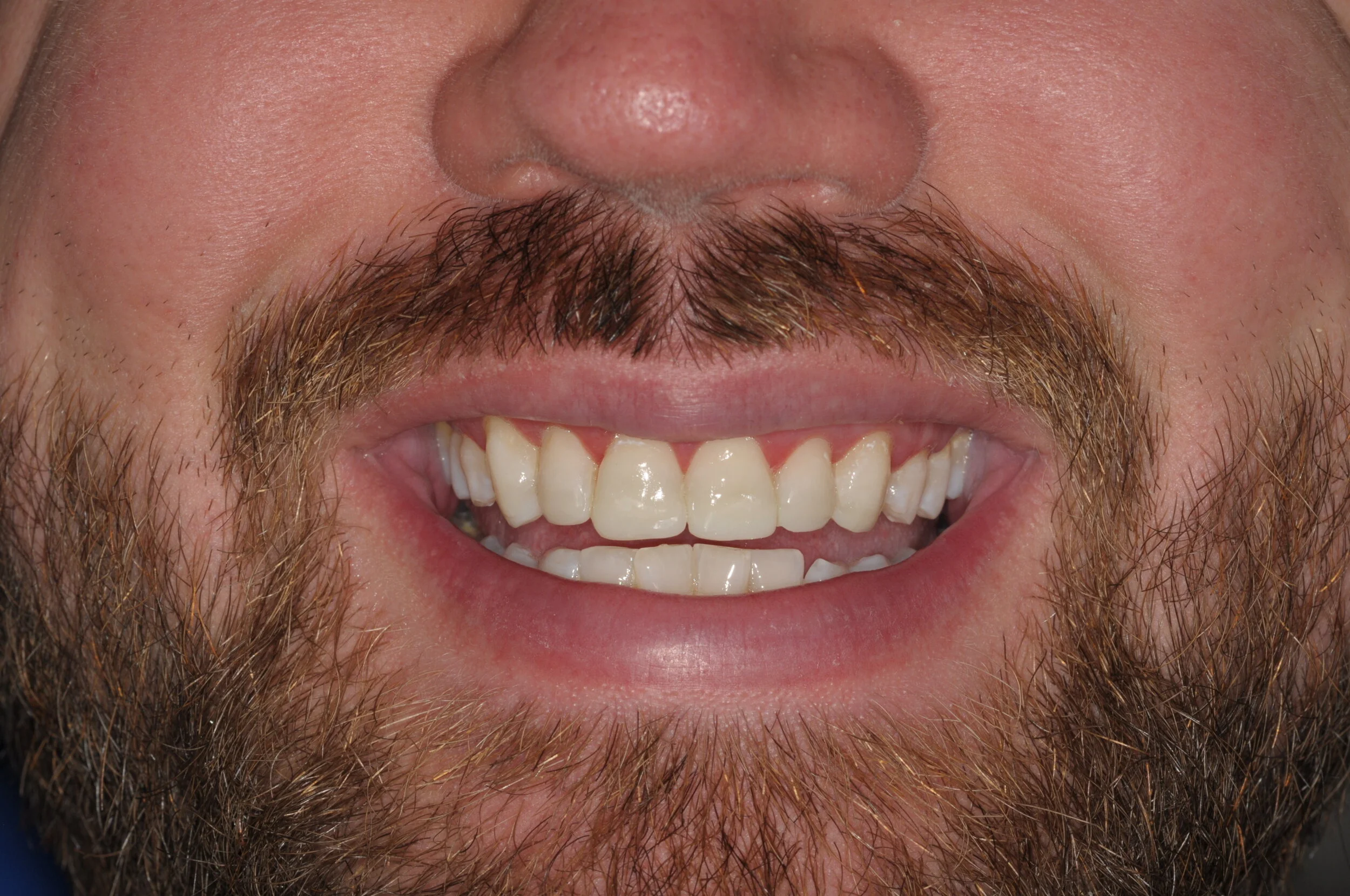 SMILE GALLERY — Devine Dental