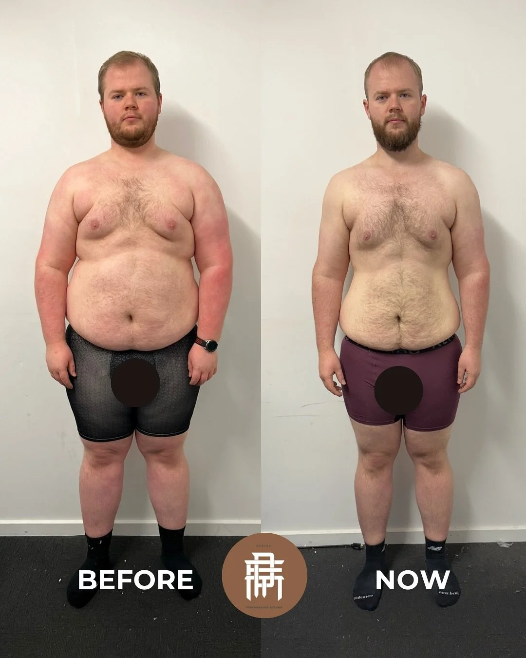 🔥 35KG DOWN &amp; COUNTING🔥
Liam&rsquo;s journey keeps getting better &mdash; from struggling with day-to-day tasks to now thriving in training, business, and life

✅ Down 35kg (and still going) ✅ Squatting well over 100kg ✅ Living proof that stren