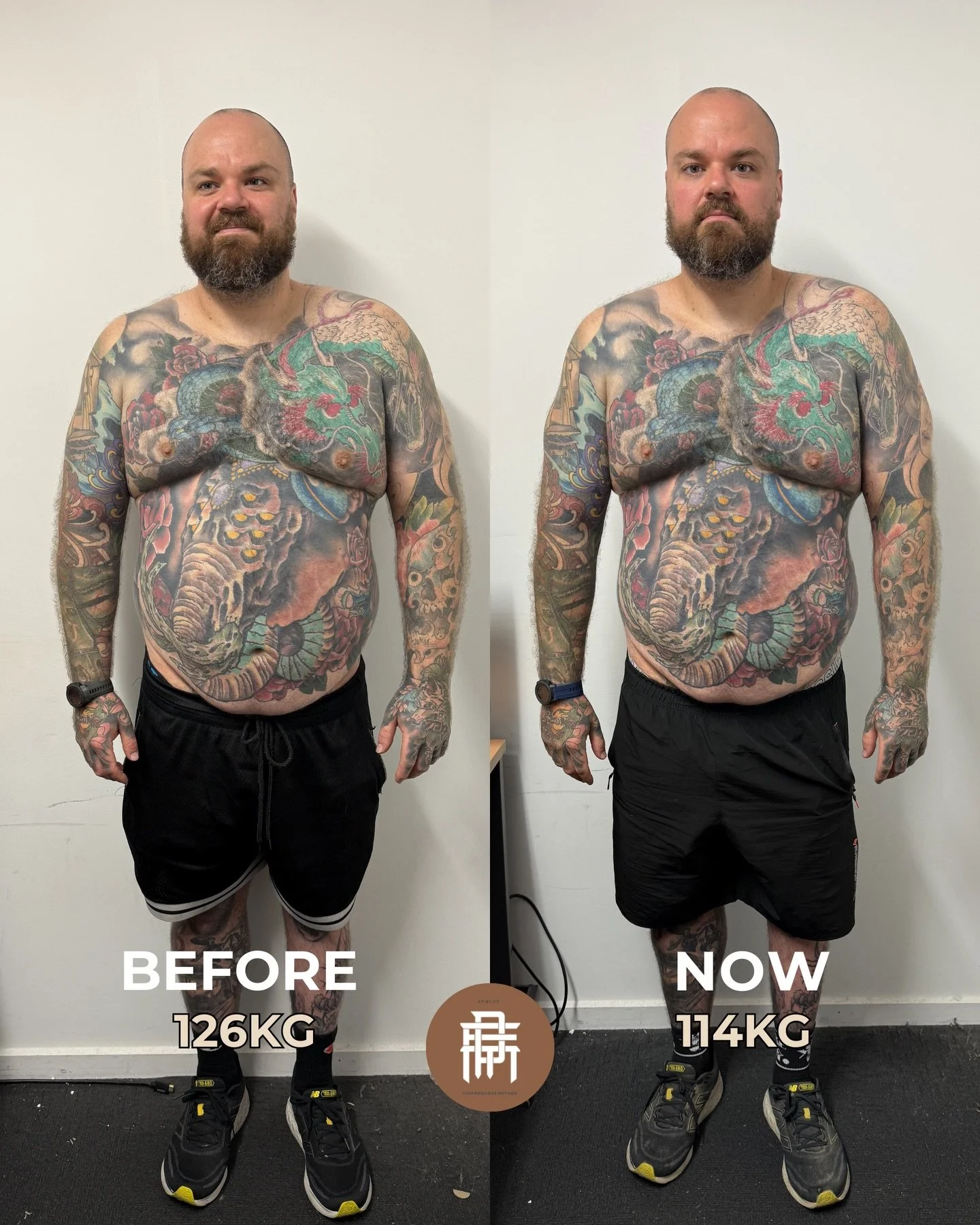 10 WEEKS &mdash; 12KG GONE 🔥🚀

Ryan came to us with a clear goal:
&nbsp;✔️Leaner physique
&nbsp;✔️Bigger, more defined arms
&nbsp;✔️Stronger legs
&nbsp;✔️A long-term target of ~15% body fat

At 15 years old, Ryan suffered from a cavernoma tumour in