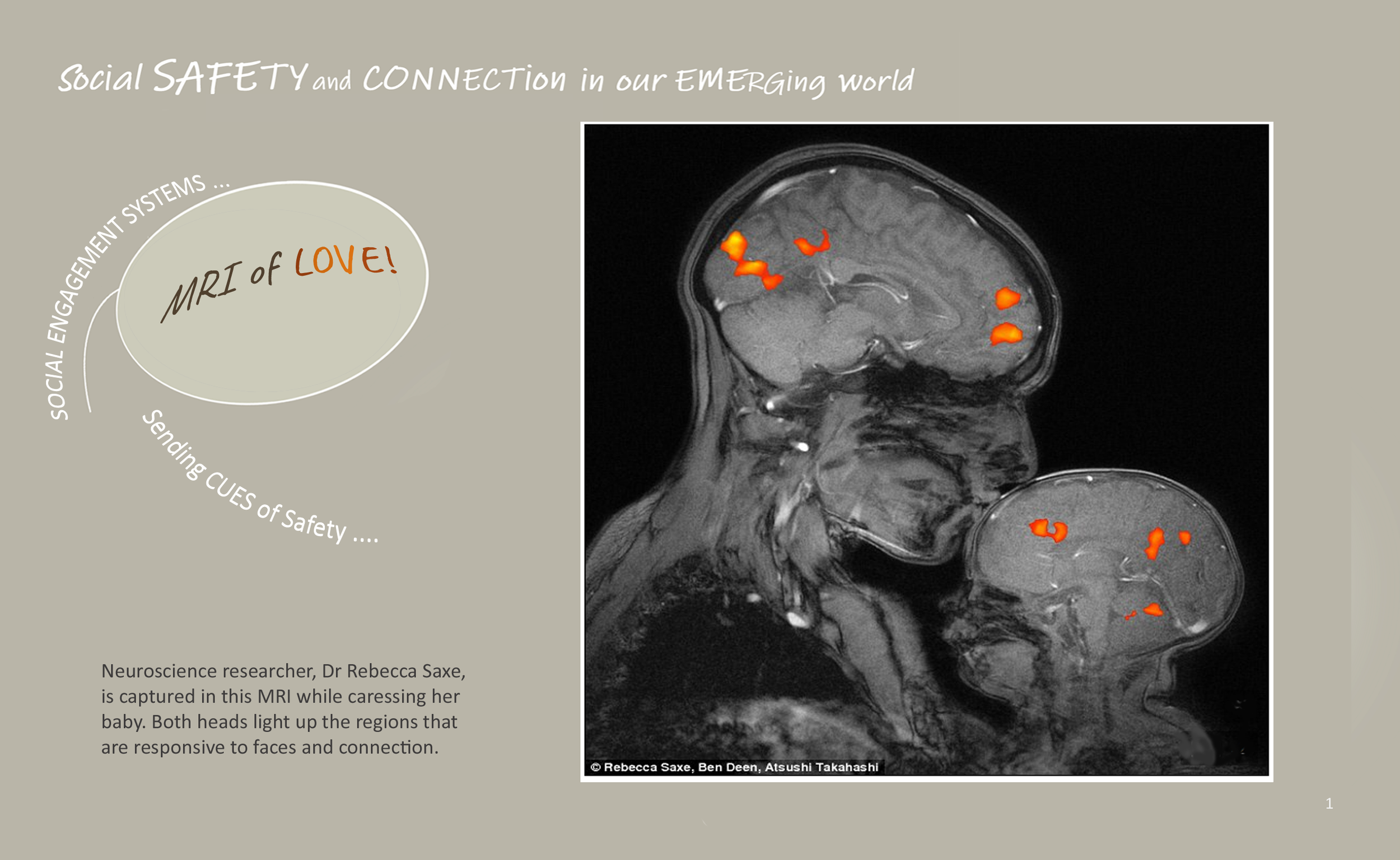 1-3VAGAL -MRI of LOVE-2.PNG