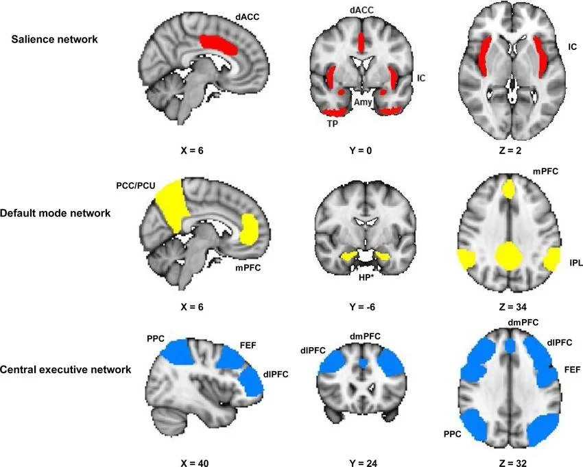 Major-functional-connectivity-networks-in-the-acute-stress-response-This-figure-is-a.png