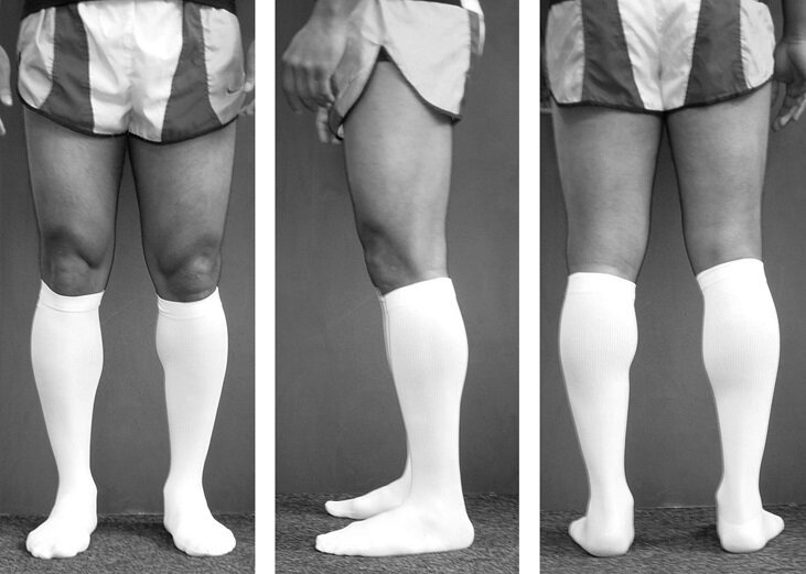 How Long Do You Wear Compression Socks After Surgery? – Dunn