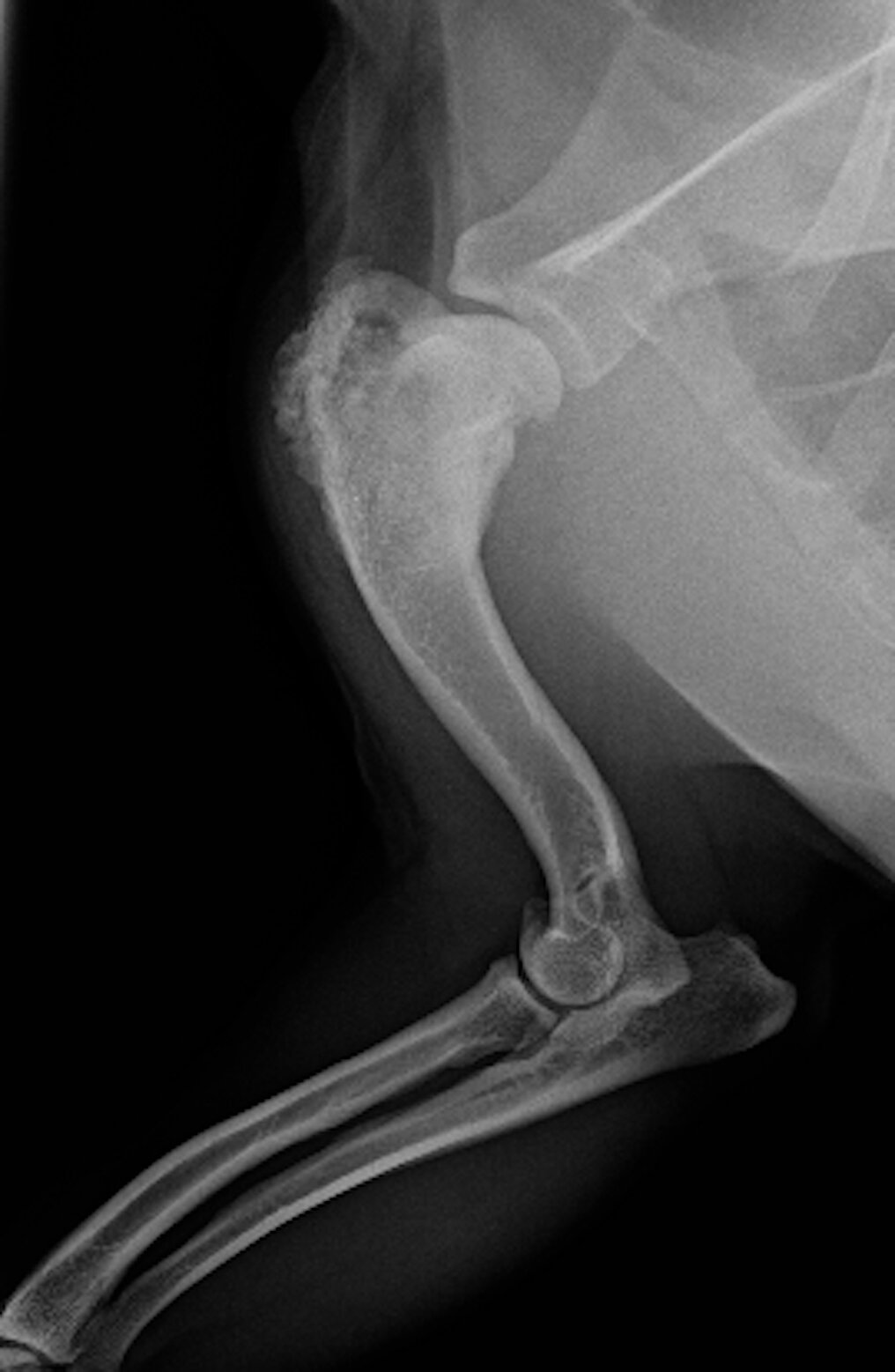 X-ray of bone cancer before treatment