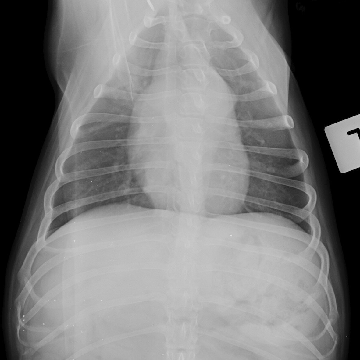 X-ray of lungs after treatment