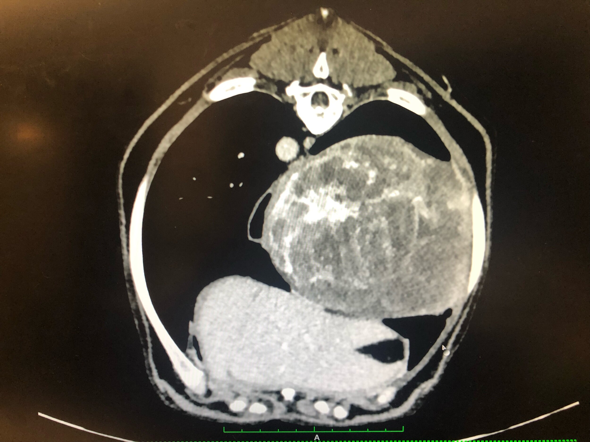 Case #1. What is your diagnosis? 