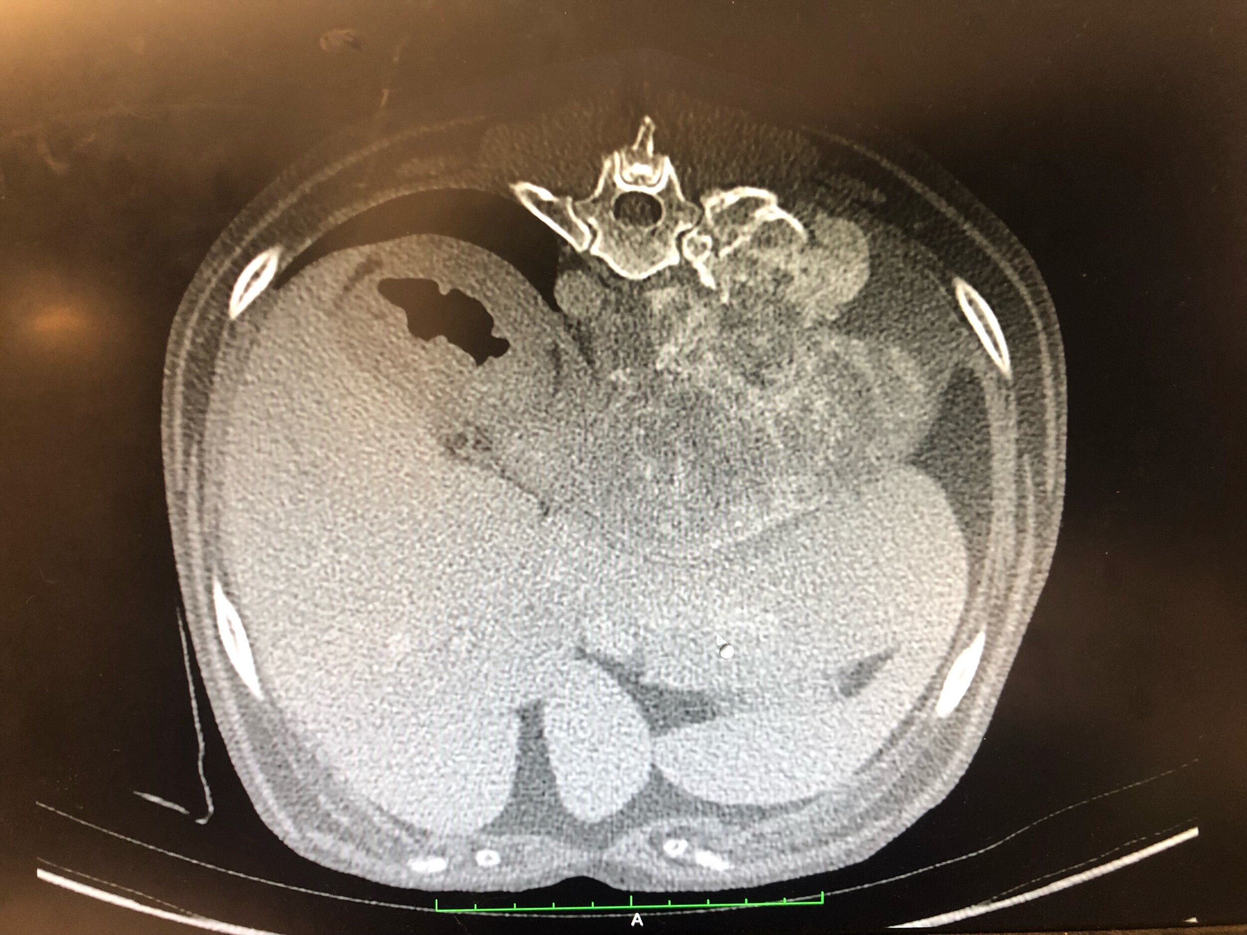 Case #1. What is your diagnosis?