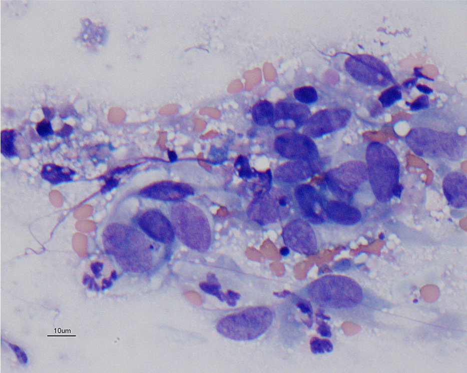 SLIDE 1. What is your diagnosis? Cytology of spleen.