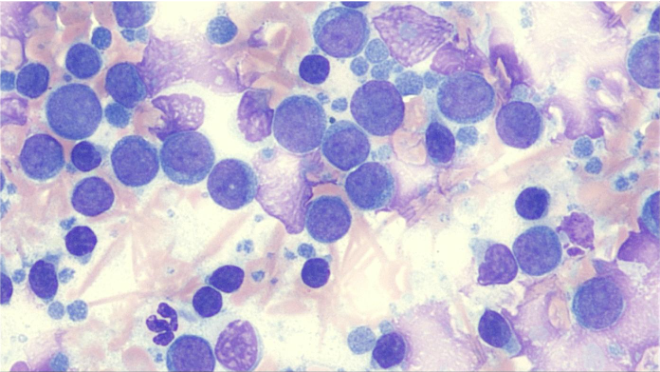 SLIDE 2. What is your diagnosis? Cytology of spleen.