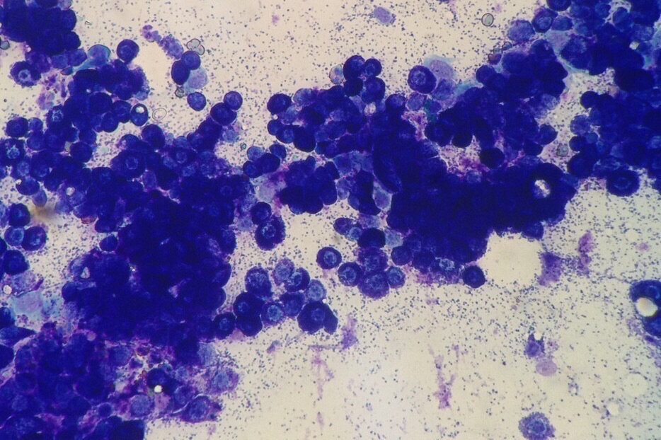 SLIDE 3. What is your diagnosis? Cytology of spleen.