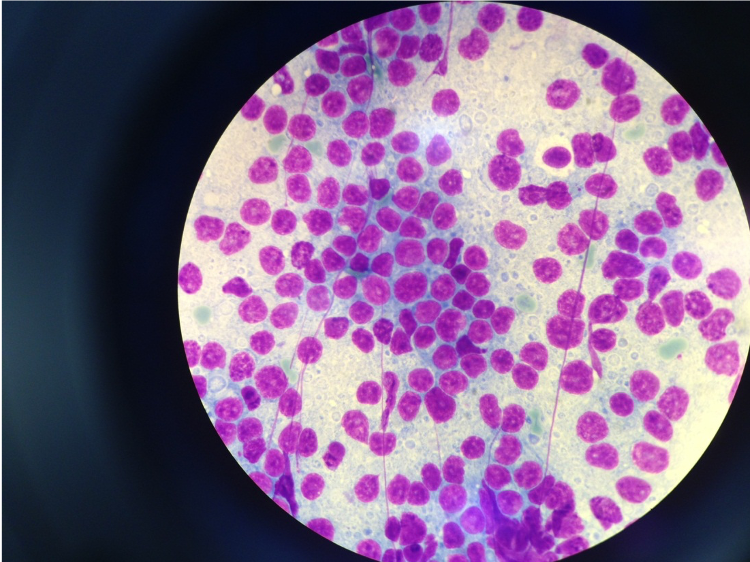 Case #4: What is your diagnosis?