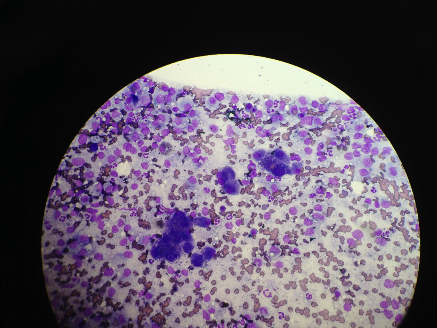 What is your diagnosis? Cytology of the liver.