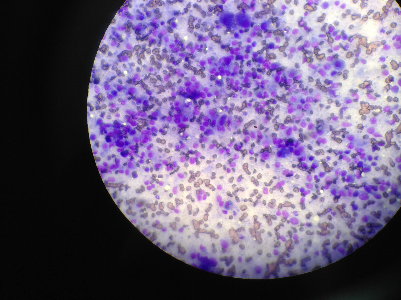 What is your diagnosis? Cytology of the liver.