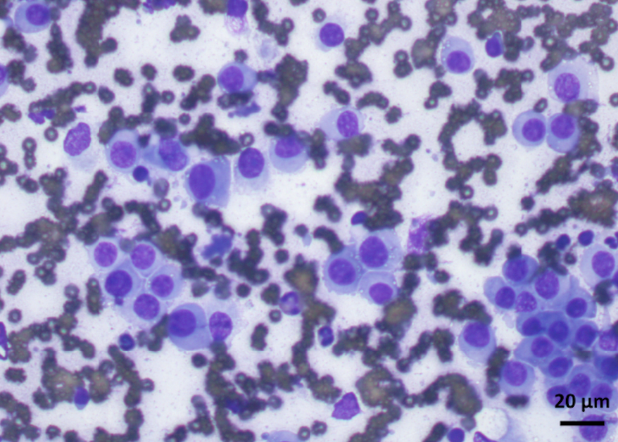 What is your diagnosis? Cytology of a penis mass.