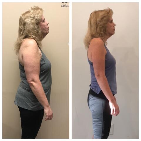 “When I first started working with Rob, I was looking at a 3rd back surgery. I was in constant pain, and on daily medication. I had back and hip pain and could barely move. I was overweight but couldn't exercise because of the pain. After working with Rob for a few months I am pain free for the first time in 15 years. Using his meal plan and exercise program I have lost over 40 lbs and I'm doing more at the gym than I ever thought was possible. Thanks to his constant support and patience he has gotten me close to my goals. I highly recommend Rob to anyone with any kind of pain issues, he is definitely good at what he does." - Brenda